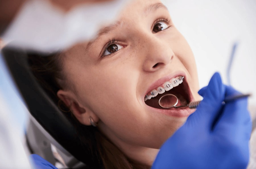 Is there an ideal age for braces?
