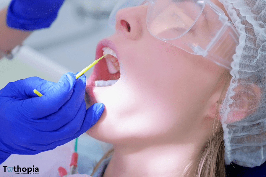 How Long Should Fluoride Varnish Stay on Teeth?