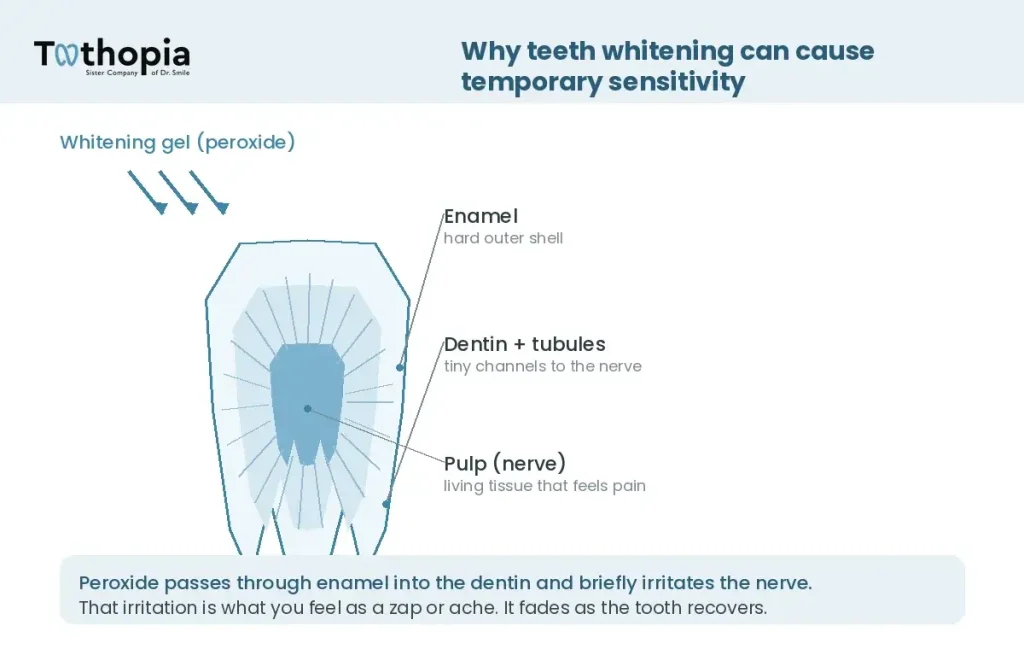 Why does teeth whitening make your teeth hurt?