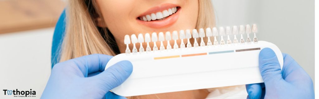 Dental Crowns VS Dental Veneers Dental Crowns VS Dental Veneers