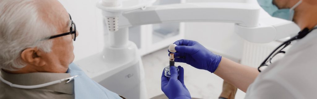 How Long Do Full Mouth Dental Implants Last? How Long Do Full Mouth Dental Implants Last?