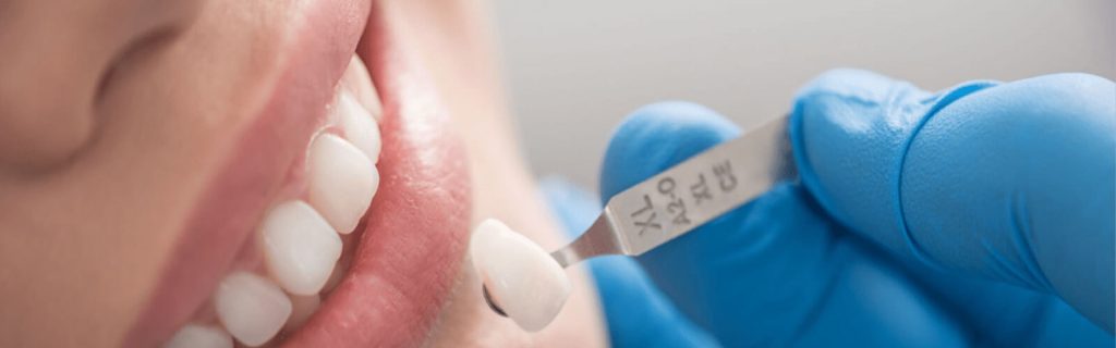 How Long Does A Root Canal Last Without A Crown? How Long Does A Root Canal Last Without A Crown?