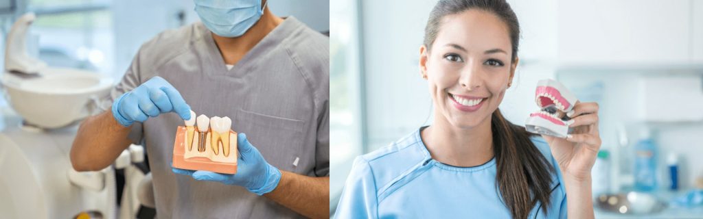 Dental Implants vs. Dentures: A Comprehensive Comparison Dental Implants vs. Dentures: A Comprehensive Comparison