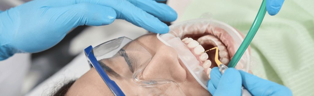 How to Prevent Dental Crowns from Falling Out: A Complete Guide How to Prevent Dental Crowns from Falling Out: A Complete Guide