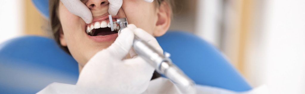 Dental Bonding Procedure Dental Bonding Procedure