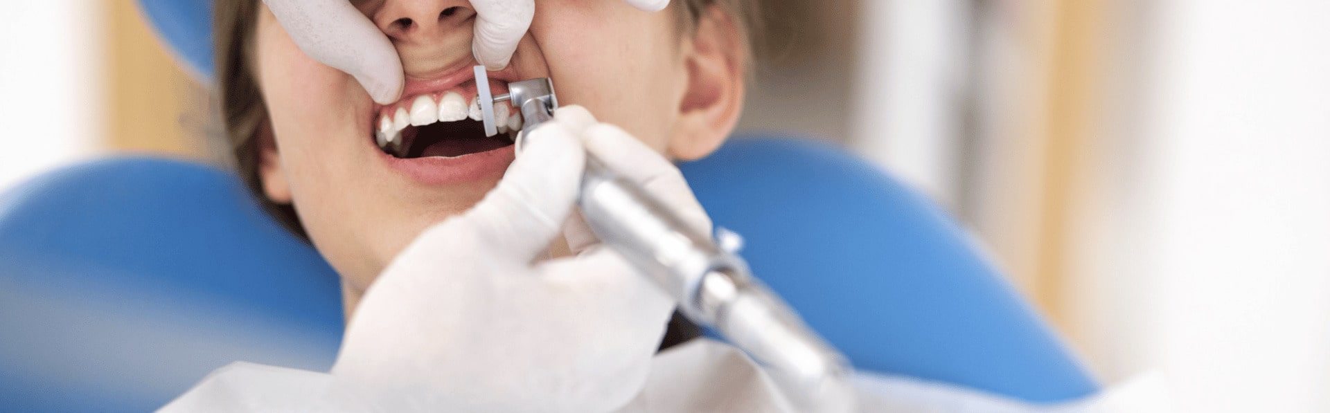 Dental Bonding Procedure