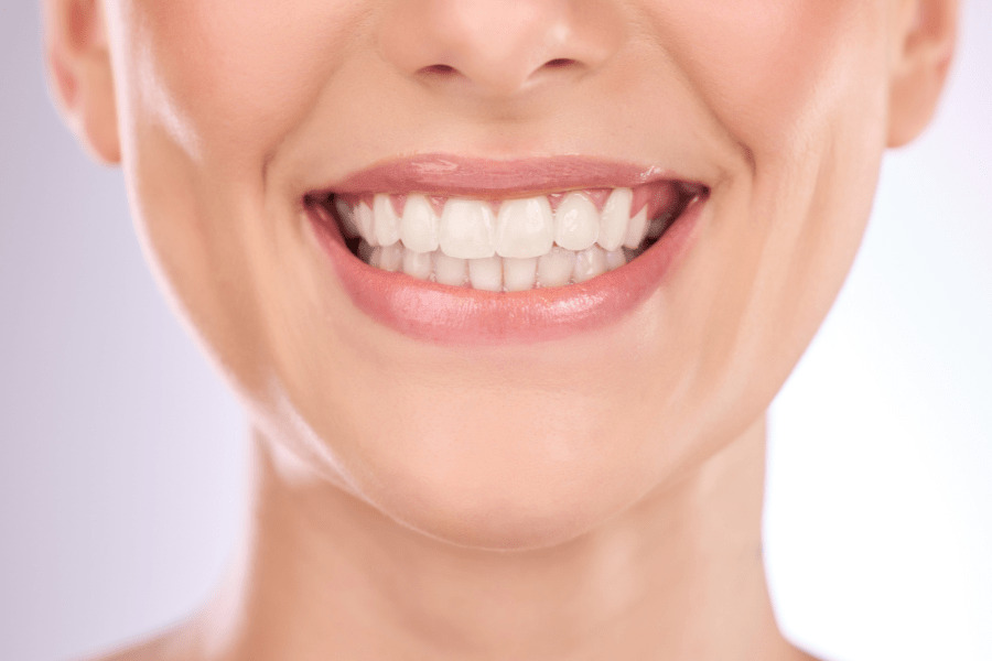Does Teeth Whitening Really Work and Is It Safe?
