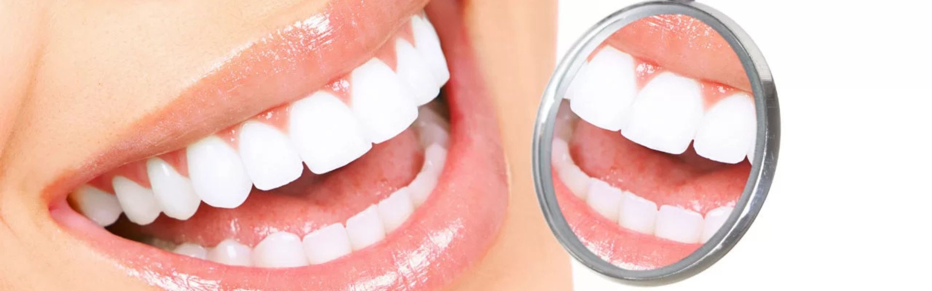 Dental Aesthetics