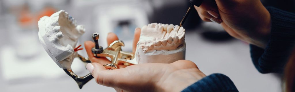Dental Implant Materials Dental Implant Materials