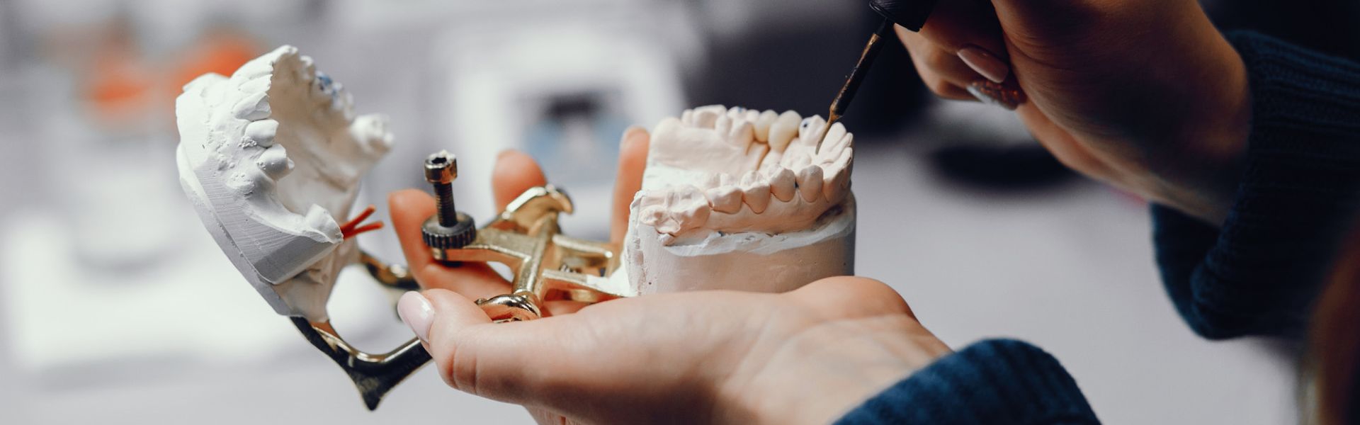 Dental Implant Materials