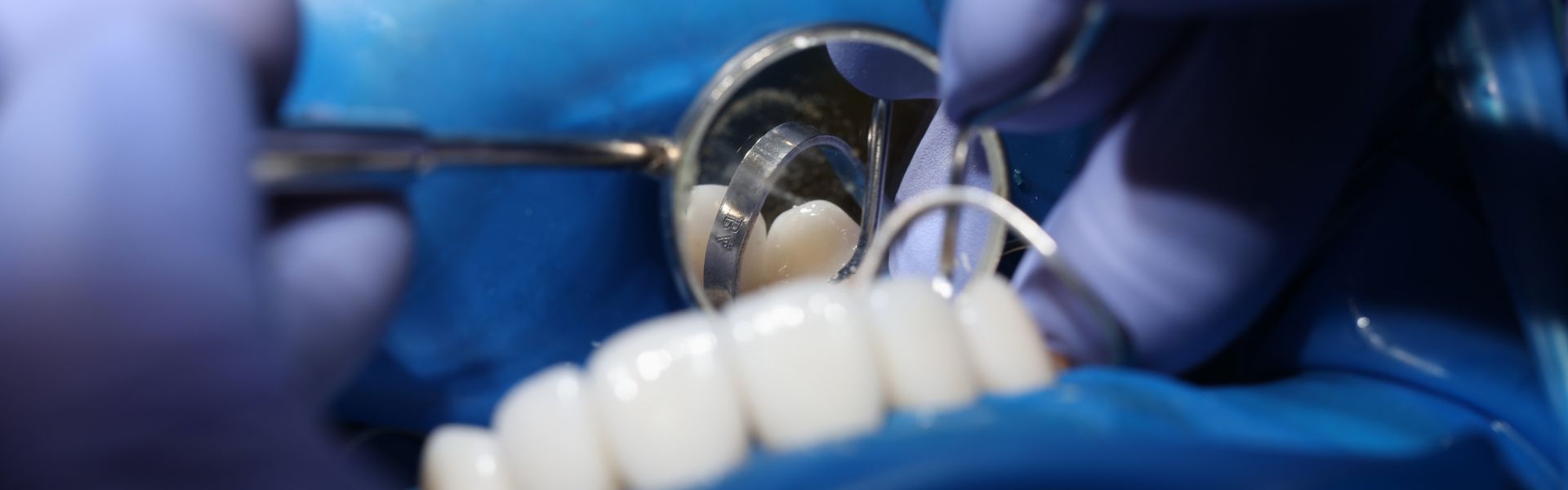 Oral Surgeon vs Dentist: Understanding the Difference
