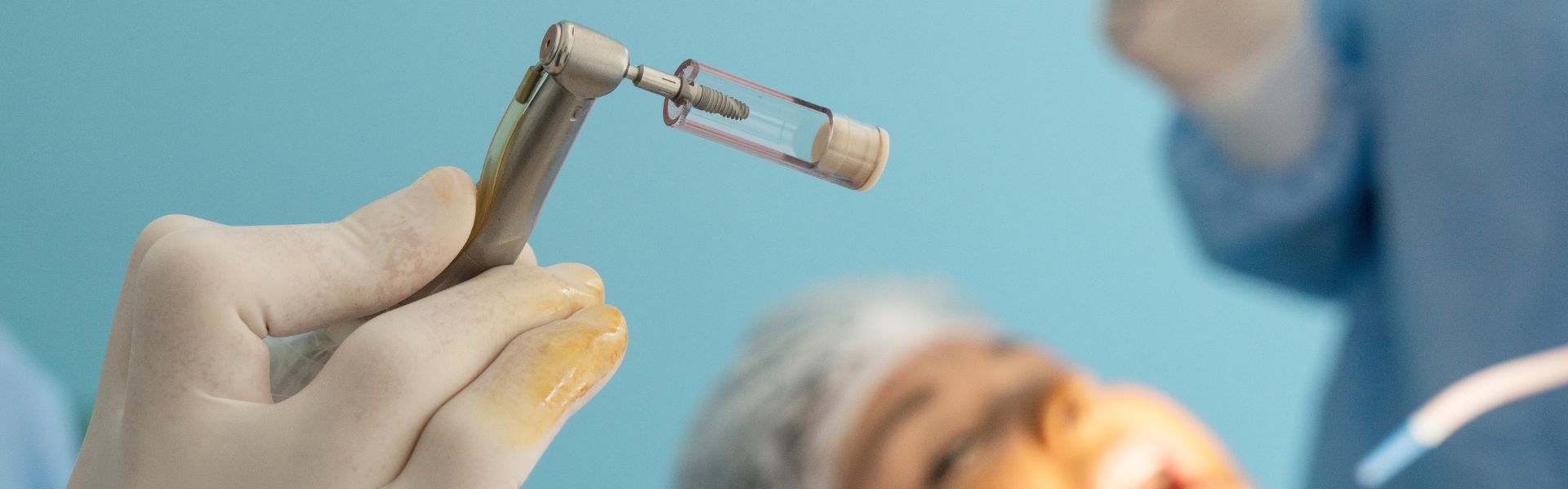 Preparing for Dental Implant Surgery