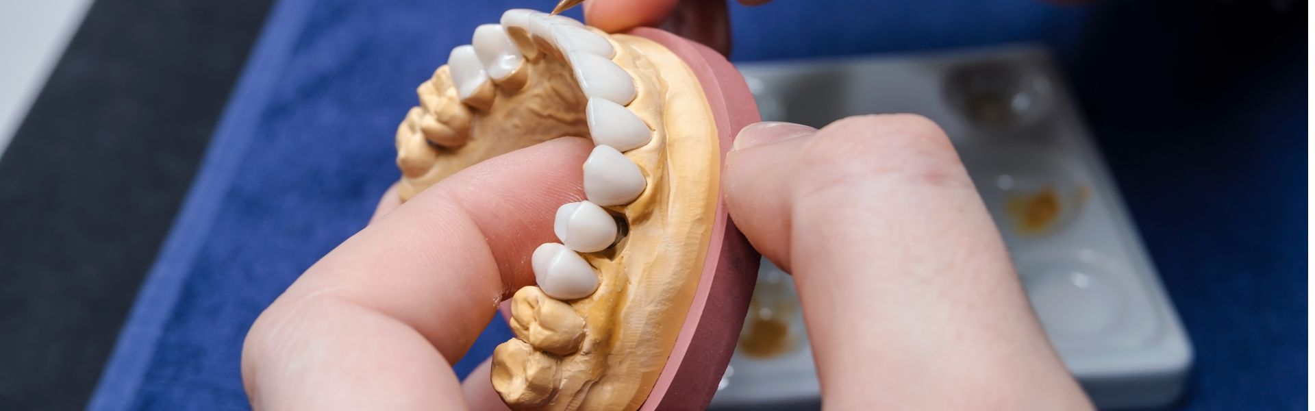 type of dentures type of dentures