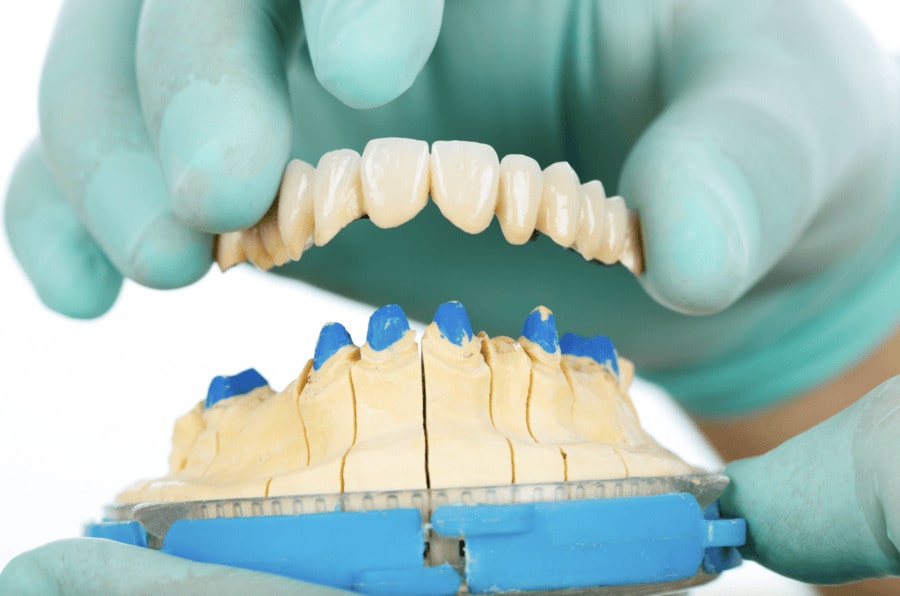 Bad Breath with a Dental Bridge
