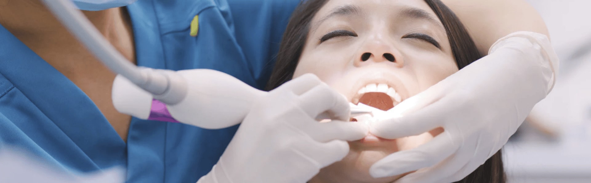 Do I Have to Get an Implant After a Root Canal?
