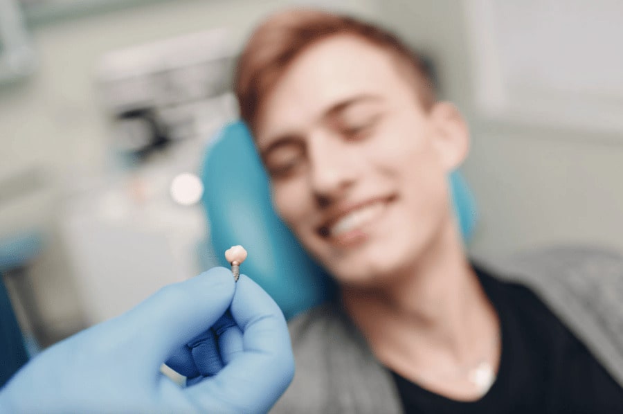 Benefits of Dental Implants After a Root Canal
