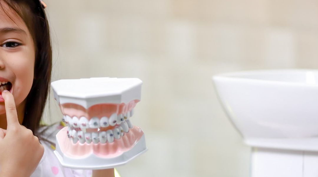 Best Types of Dental Crowns for Kids