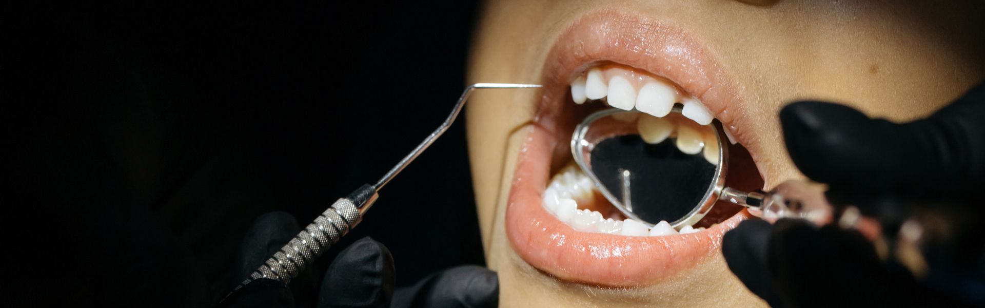 Guided Biofilm Therapy Guided Biofilm Therapy