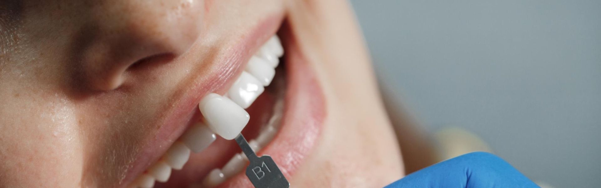Dental Bonding Can Fix Gaps