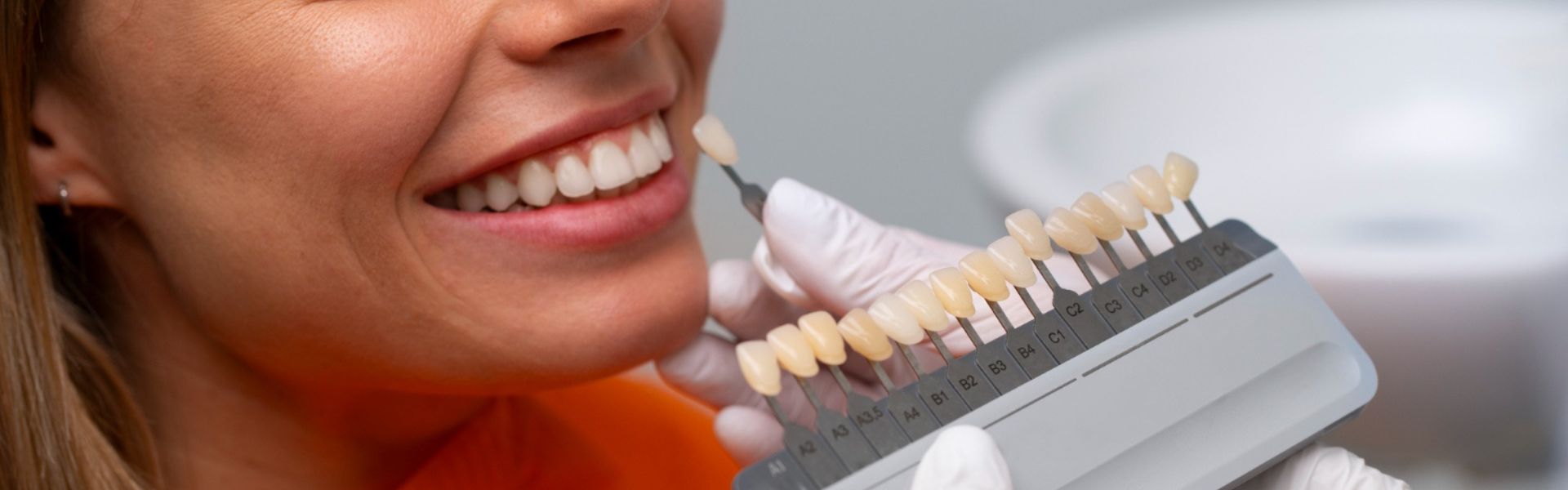 Learn About the Different Types of Dental Veneers