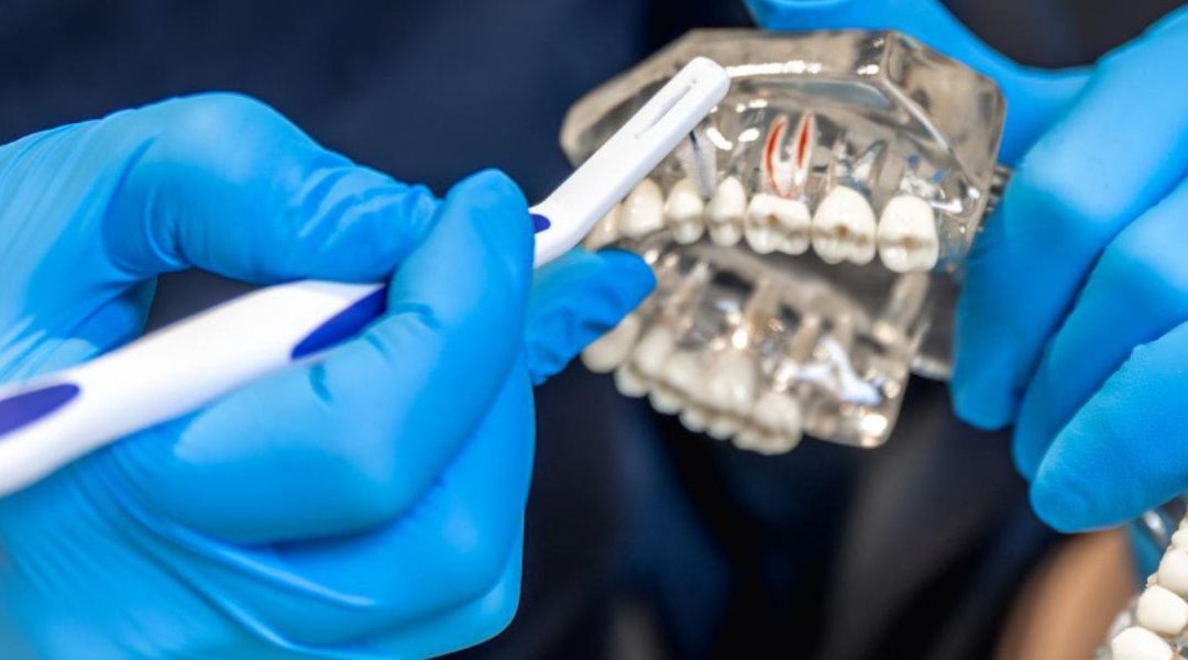 Dental Bridge vs Implant