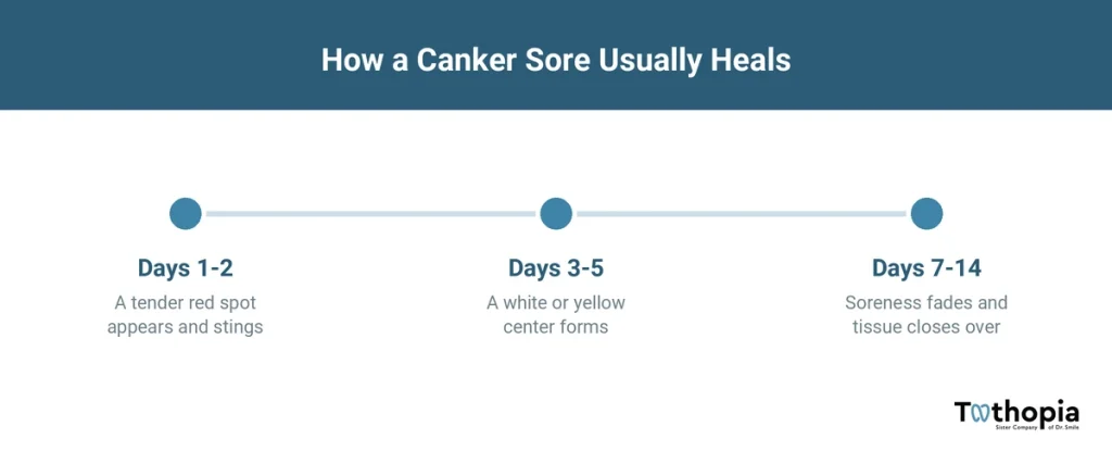 Canker sore healing timeline