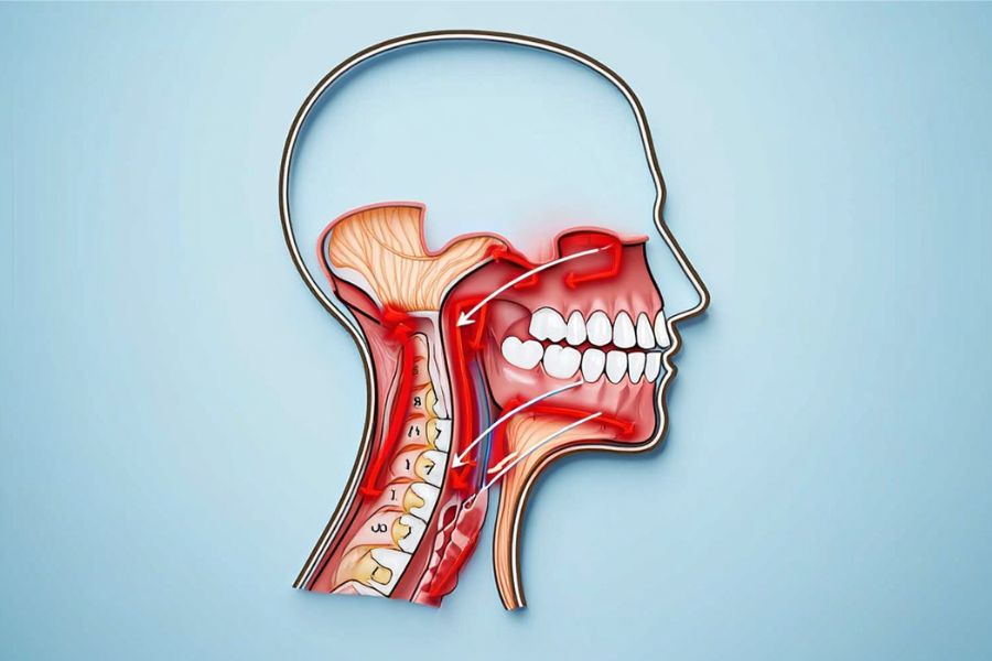 How to Prevent Throat Pain After Extraction