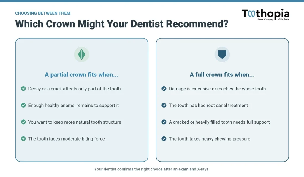 Decision guide listing when a partial crown fits versus when a full crown fits, based on damage, remaining tooth, and bite force