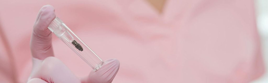 Everything You Need to Know About Mini Dental Implants