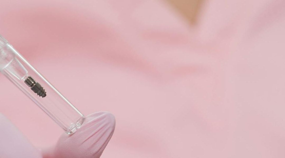 Mini Dental Implants Guide