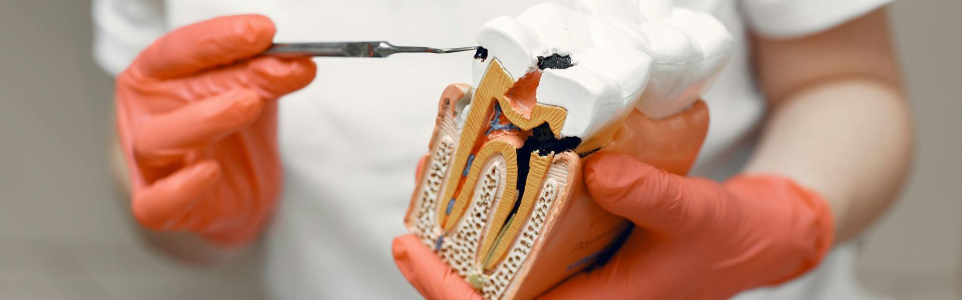 How to Prevent Tooth Decay Effectively