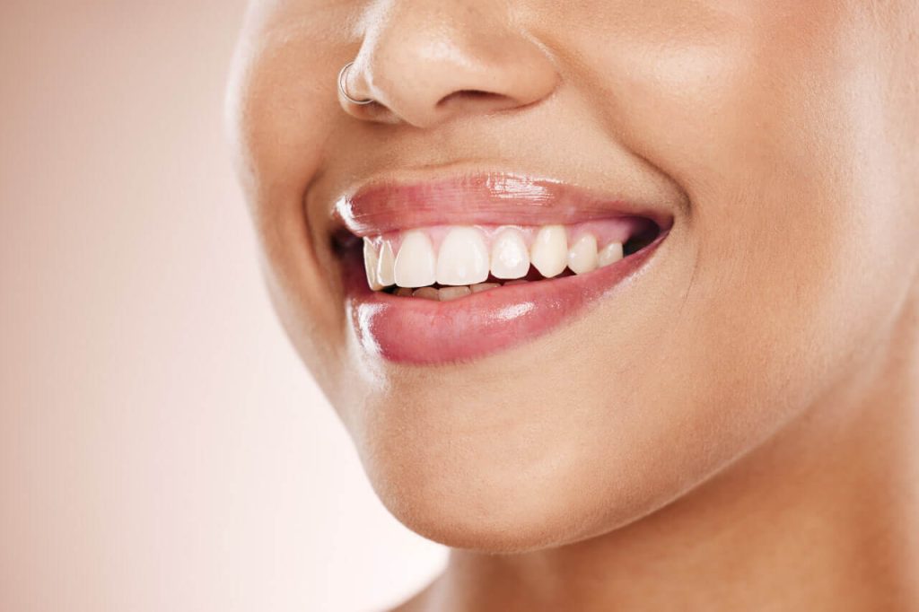 Alternatives to Zoom Whitening