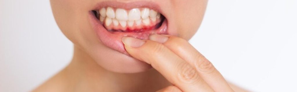 Can gum disease kill you Can gum disease kill you