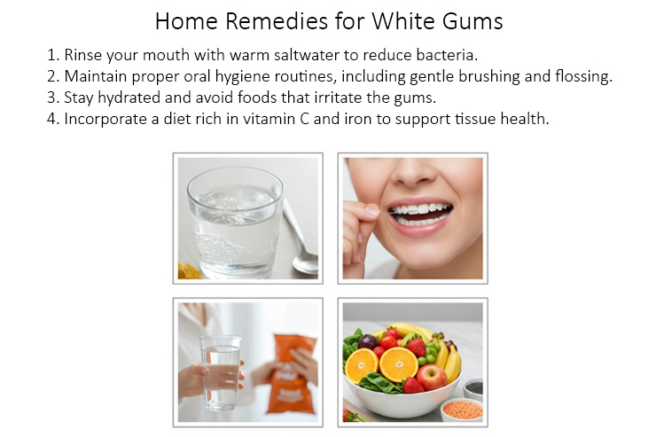 Home Remedies for White Gums