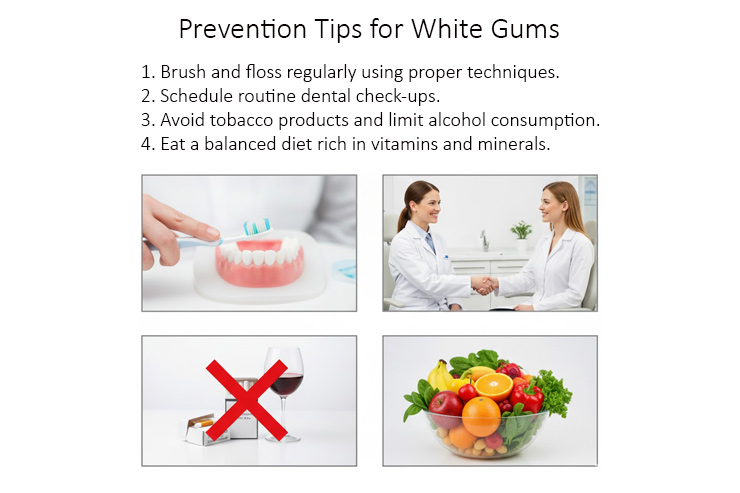Prevention Tips for White Gums