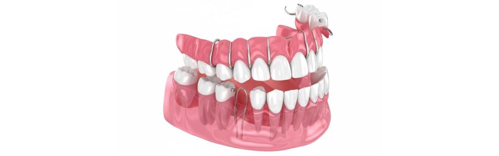 What Is a Dental Flipper and When Is It Used?
