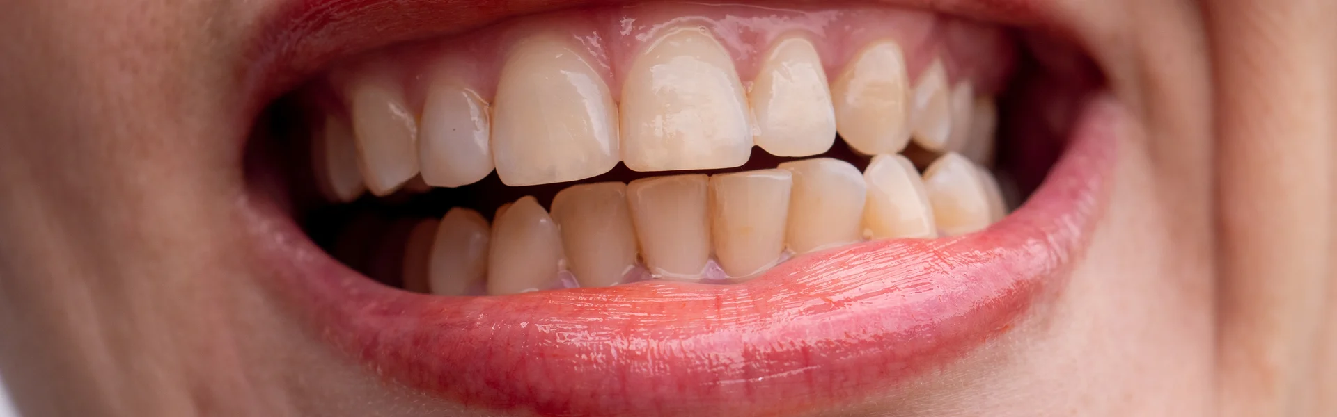 Why-Are-My-Teeth-Yellow-When-I-Brush-Them-Every-Day-2 Why-Are-My-Teeth-Yellow-When-I-Brush-Them-Every-Day