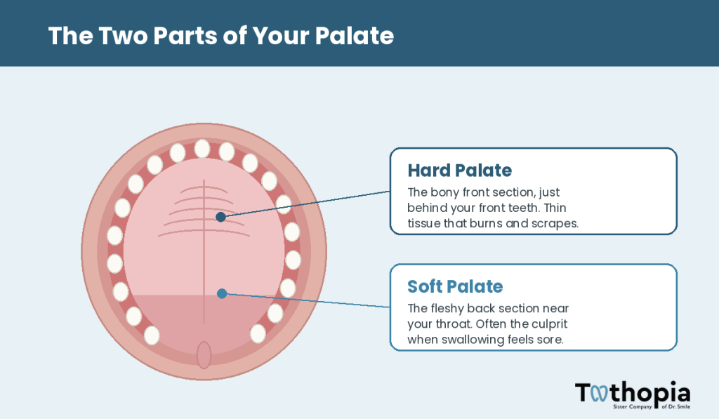 palate anatomy